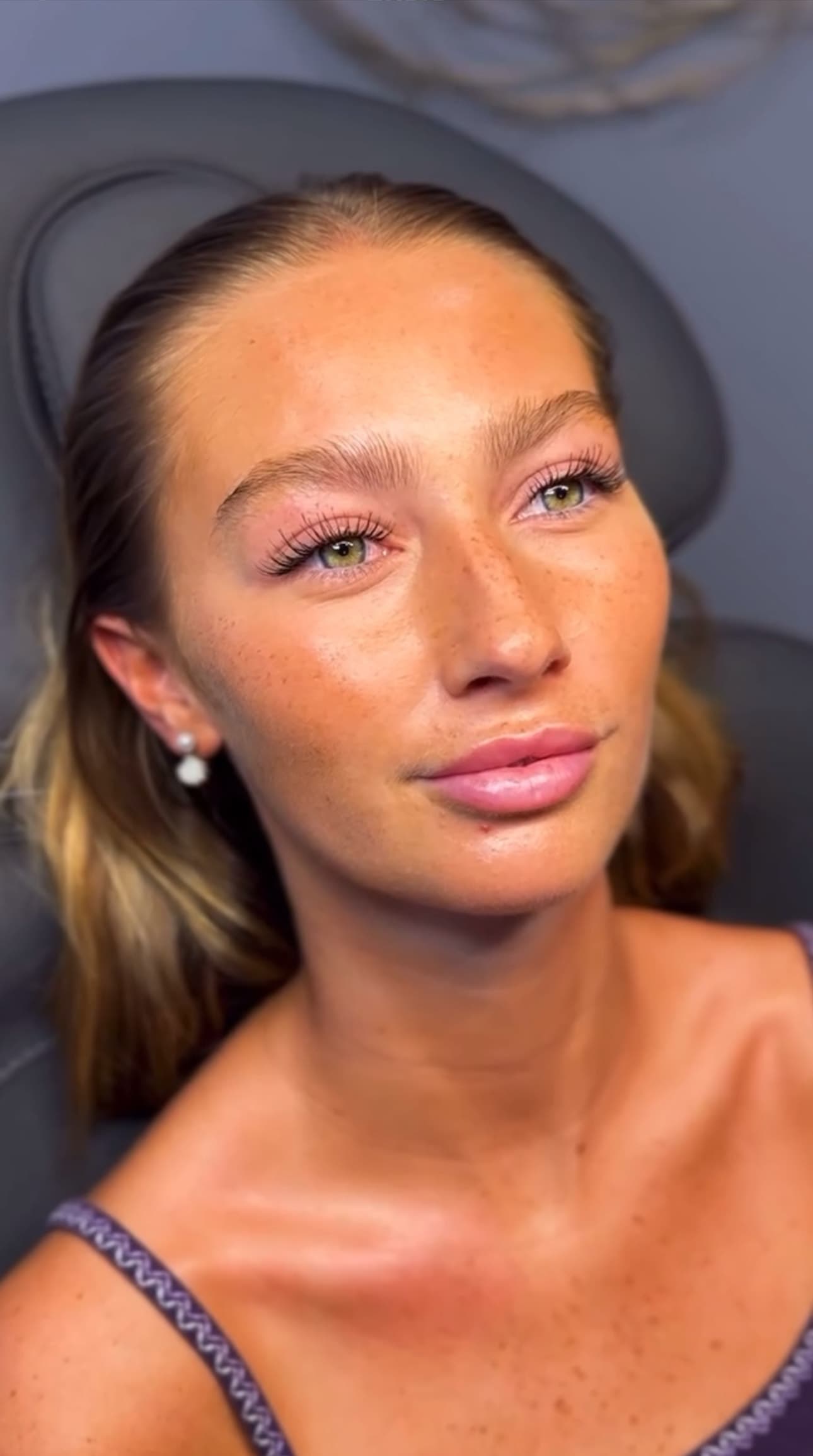 Facial treatment results showing glowing skin