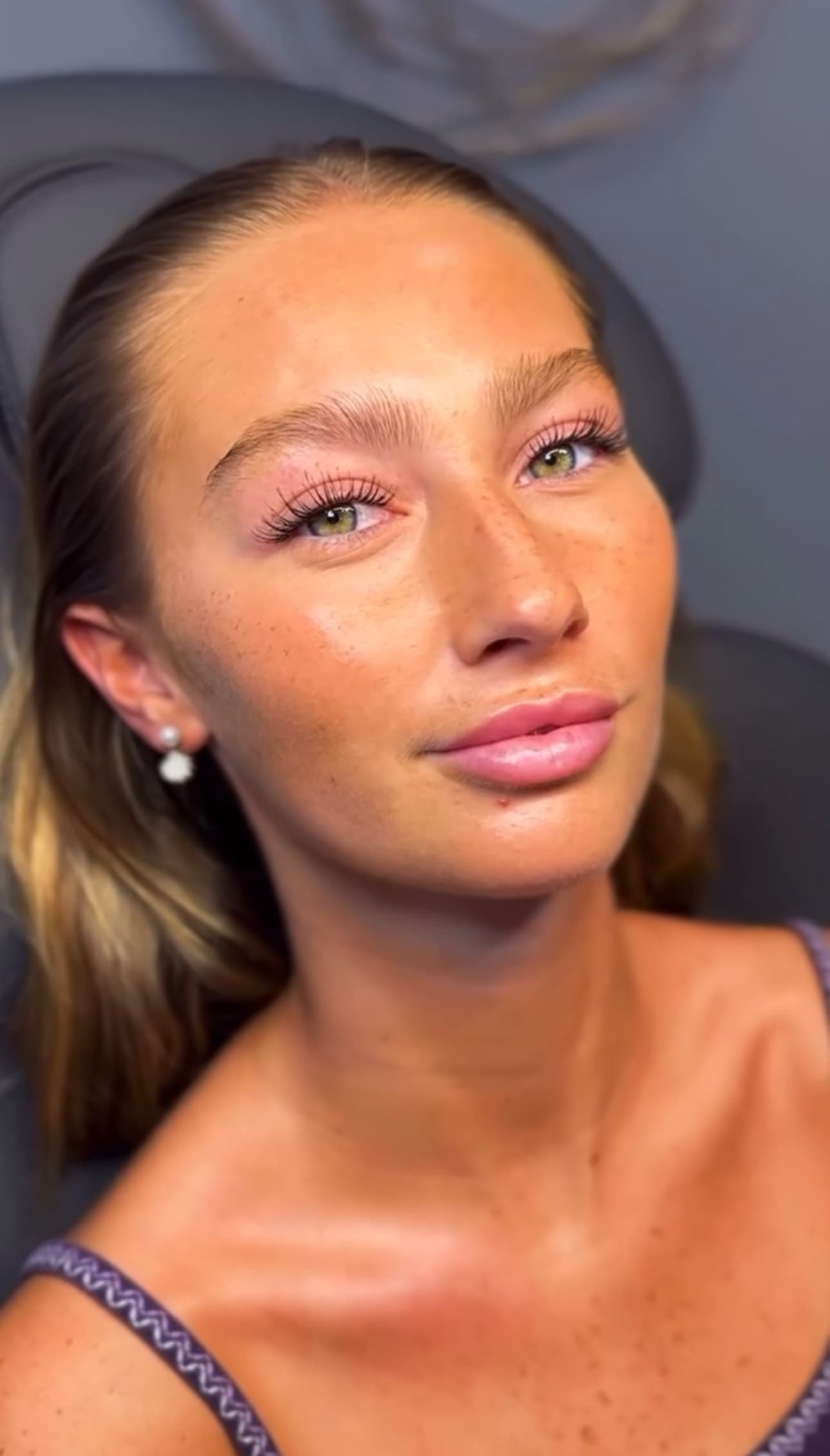 Complete facial enhancement results